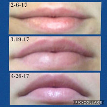 LipVolumizer